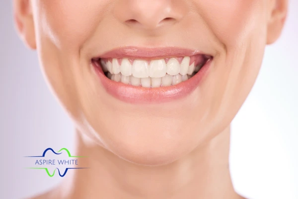 Follow your teeth whitening aftercare Oxford to prolong your whiter smile!