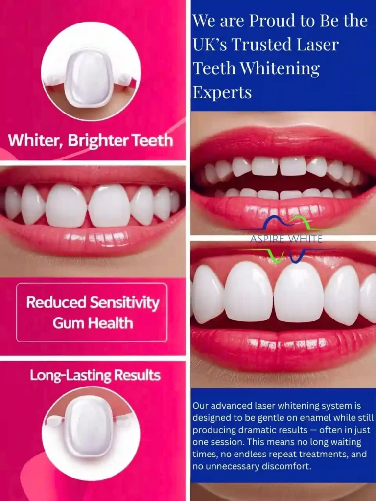 We are Proud to Be the UK’s Trusted Laser Teeth Whitening Experts Oxford
